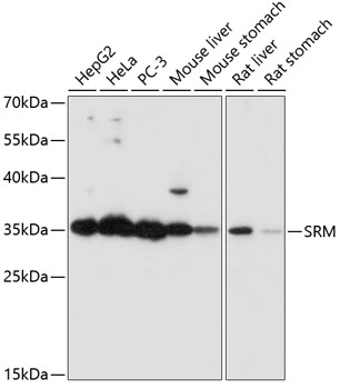 A8151_SRM_WB.jpg
