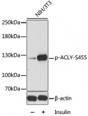 Phospho-ACLY-S455 Rabbit pAb (AP0779)