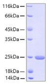 Recombinant Human FGF-21 Protein (RP00049)