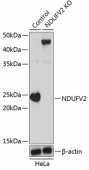 [KO Validated] NDUFV2 Rabbit pAb (A19936)