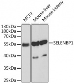 [KO Validated] SELENBP1 Rabbit pAb (A1222)