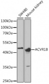 ACVR1B Rabbit pAb (A5453)