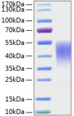 Recombinant Mouse TIM-3/HAVCR2/CD366 Protein (RP01152)