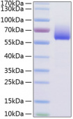 Recombinant Mouse TIM-3/HAVCR2/CD366 Protein (RP01153)