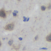 Anti -Acetylcholinesterase Rabbit PAb IHC IF Polyclonal Antibody