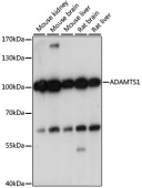 ADAMTS1 Rabbit pAb (A15356)