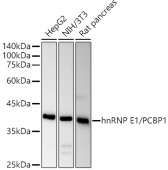[KO Validated] hnRNP E1/PCBP1 Rabbit pAb (A21733)