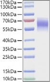 Recombinant Mouse FGFR-4/CD334 Protein (RP01469)