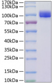 Recombinant Mouse VCAM-1/CD106 Protein (RP01176)