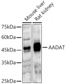 AADAT Rabbit pAb (A13090)