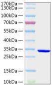 Recombinant Schistosoma japonicum GST Protein (RP02000LQ)
