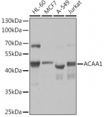 ACAA1 Rabbit pAb (A14700)