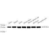 Anti -AGXT2L2 Rabbit pAb