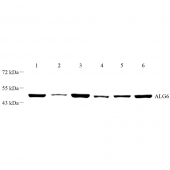 Anti -ALG6 Rabbit pAb