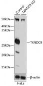 [KO Validated] TXNDC9 Rabbit pAb (A19869)