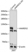 [KO Validated] ANKRD52 Rabbit pAb (A19958)