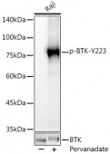 Phospho-BTK-Y223 Rabbit mAb (AP1136)