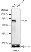 [KO Validated] YAP1 Rabbit mAb (A21216)