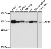 [One Step]RPA2 Antibody Kit (RK05696)