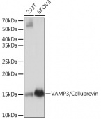 VAMP3/Cellubrevin Rabbit mAb (A8812)