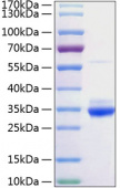 Recombinant Rat C-Reactive Protein/CRP Protein (RP01072)