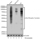 Pan Phospho-Tyrosine Rabbit mAb (AP1162)