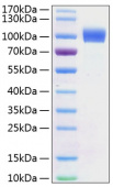 Recombinant Mouse ErbB-2/HER2/CD340 Protein (RP01165)