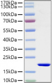 Recombinant Mouse IL-1 beta Protein (RP01340)