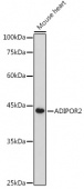 ADIPOR2 Rabbit pAb (A12777)