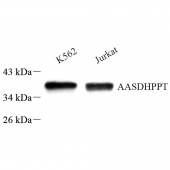 Anti -AASDHPPT Rabbit pAb