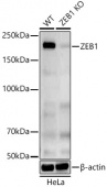 [KO Validated] ZEB1 Rabbit pAb (A22244)