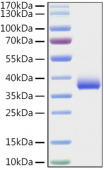 Recombinant SARS-COV-2 Spike RBD(E484K) Protein (RP01330)