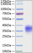 Active Recombinant Mouse TNFRSF1A/TNF-R1/CD120a Protein (RP01074)