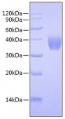 Recombinant Mouse TNFSF9/4-1BB Ligand Protein (RP00766)
