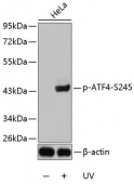 Phospho-ATF4-S245 Rabbit pAb (AP0309)