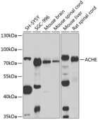ACHE Rabbit pAb (A2806)