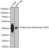 Adenosine Deaminase (ADA) Rabbit pAb (A1019)