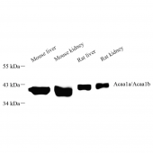 Anti -ACAA1/Beta-ketothiolase Rabbit pAb