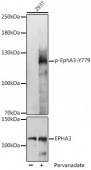 Phospho-EphA3-Y779 Antibody kit (RK06006)