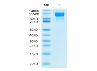 Biotinylated Recombinant Human EGFR Protein (RP02349)