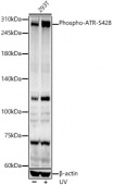 Phospho-ATR-S428 Rabbit pAb (AP0676)