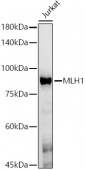 [KO Validated] MLH1 Mouse mAb (A21882)