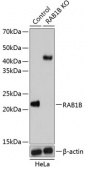 [KO Validated] RAB1B Rabbit pAb (A19935)