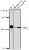 VPS18 Rabbit mAb (A17563)