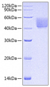 Recombinant Rat B7-H1/PD-L1/CD274 Protein (RP00800)