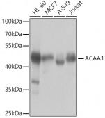 ACAA1 Rabbit pAb (A7422)