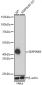 [KO Validated] SERPINB5 Rabbit pAb (A1179)