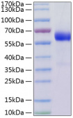 Recombinant Human TNFRSF3/TNFR-III/LTBR Protein (RP01179)