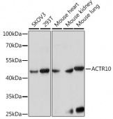 ACTR10 Rabbit pAb (A15867)