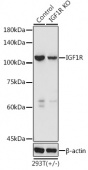 [KO Validated] IGF1R Rabbit pAb (A0243)